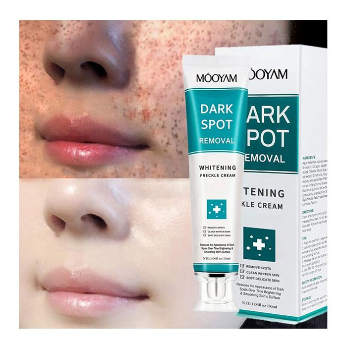MOOYAM Dark Spot Removal Cream